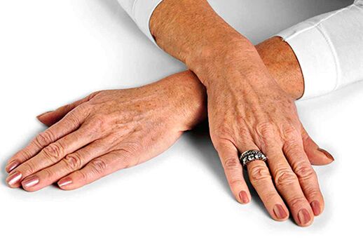 Age-related changes in hand skin require the use of rejuvenation techniques